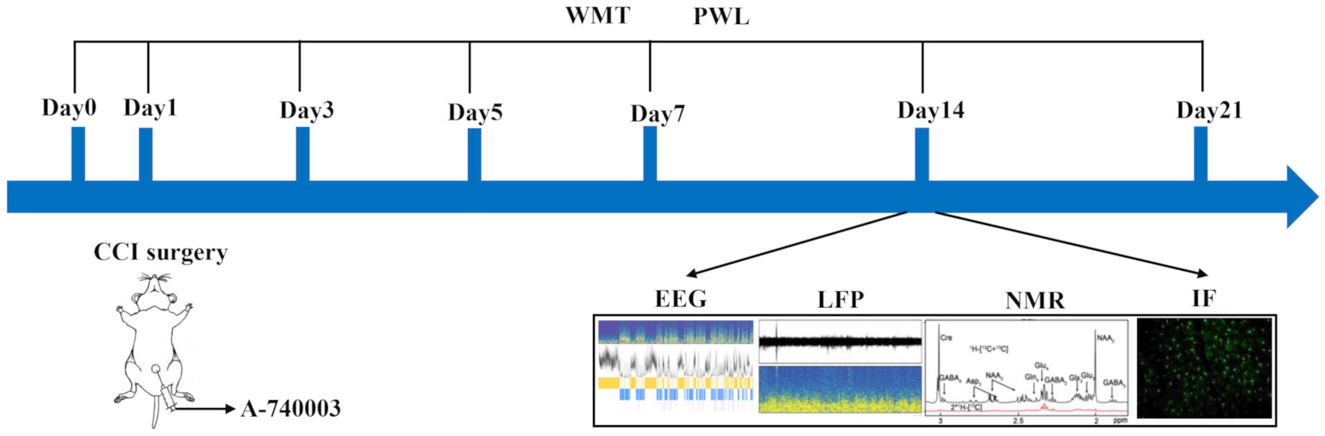 P2X7 receptor-activated microglia in cortex is critical for sleep disorder under neuropathic pain